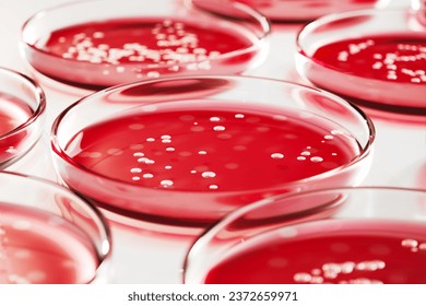 petri dish showing bacterial growth staphylococcus aureus, macro photography, lab setting
